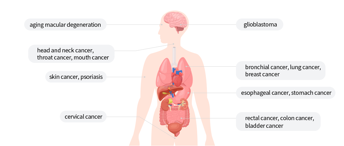 교모세포종/노화황반변성/두부경부암,인후두암,구강암/기관지암,폐암,유방암/피부암,건선/식도암,위암/직장암,대장암,방광암/자궁경부암